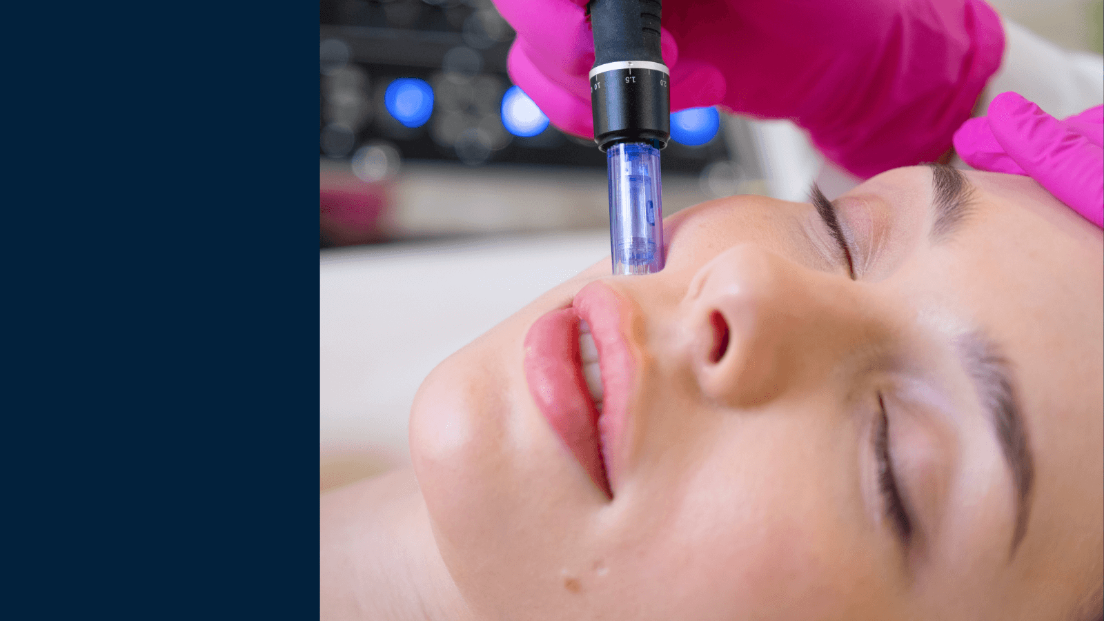 Image for Endpoint with Skin-Needling Treatments